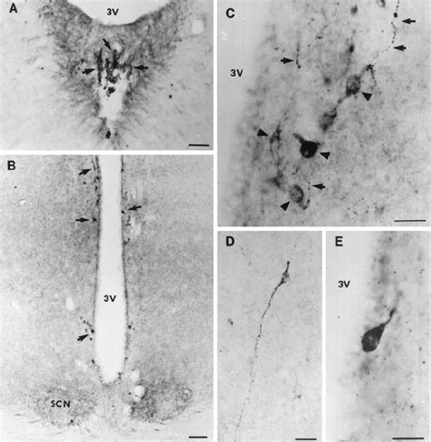 Immunohistochemical visualization of sst 1 receptor in coronal sections ...