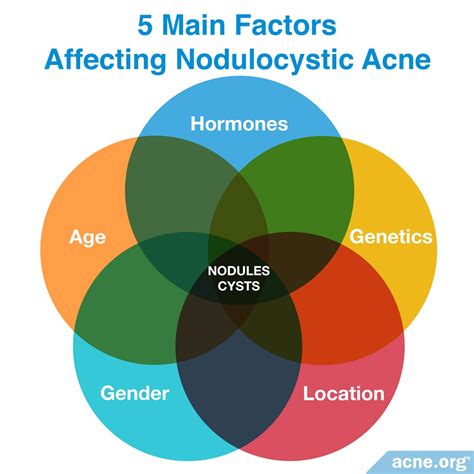 What Is an Acne Nodule? - Acne.org