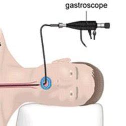 Gastroscopy procedure and a typical image | Download Scientific Diagram