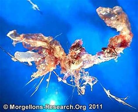 morgellons microscopic pictures photos fibers gmo pics