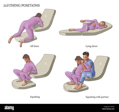 Ilustración de cuatro diferentes posiciones durante el parto: todos los fours, acostada, en ...