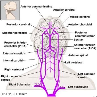 Neuroanatomy Online: Lab 4 (ƒ3) - The Ventricles and Blood Supply ...