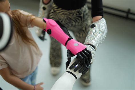 FAQ 10: Does health insurance cover prosthetics? - Open Bionics