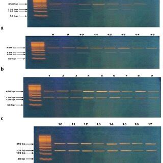 a, b RT- PCR of AA patient samples with no or minimal expression of ATM ...