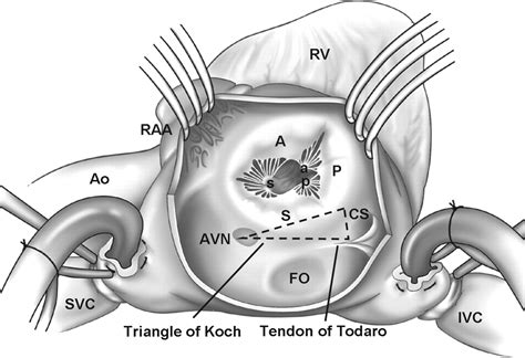 Tricuspid Valve Leaflets