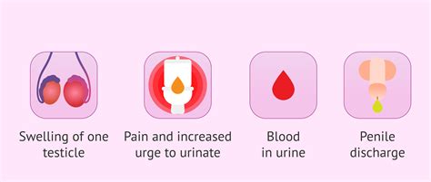 Symptoms of epididymitis