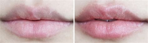 theNotice - Deciem NIOD Lip Bio-Lipid Concentrate review, before & after photos - theNotice
