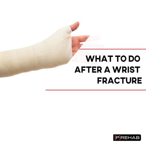 What To Do After A Wrist Fracture With Exercises - [P]rehab