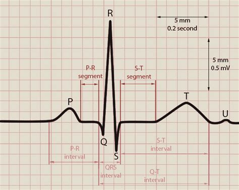 ECG Guide for Portable Handheld ECG EKG Users | Favoriteplus.com Blog