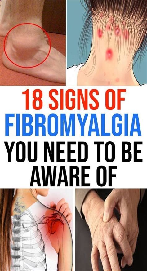 43 Signs of Fibromyalgia You Should Be Aware Of Outstanding | Signs of fibromyalgia, Diagnosing ...