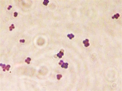 Gram Positive Cocci in Tetrads (Micrococcus spp.) | Micrococ… | Flickr