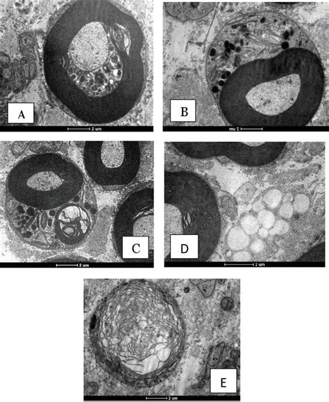 Schwann Cell Plasticity in Peripheral Nerve Regeneration after Injury | IntechOpen