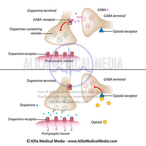 Alila Medical Media | Opiate mechanism of action (morphine, heroin ...