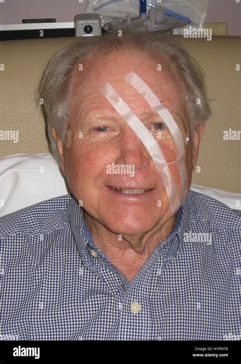 A clear plastic eye shield has been taped over the left eye of an elderly man following surgery ...