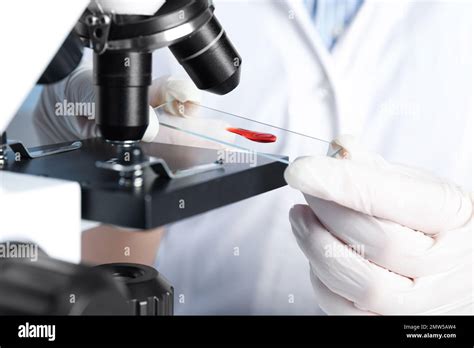 Scientist holding slide with blood sample near microscope in laboratory ...