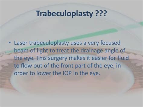 Laser trabeculoplasty