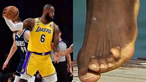 LeBron James Toes: Does the King Need Toe Surgery? Have His Signature ...