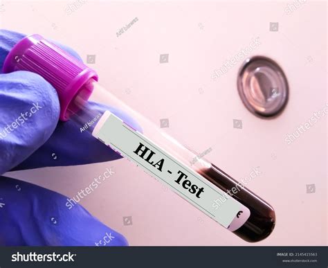 40 Hla lab Stock Photos, Images & Photography | Shutterstock