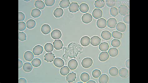 Types Of Cells Under Microscope