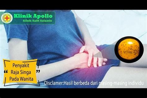 Pengobatan Penyakit Raja Singa Pada Wanita | by Klinik Apollo Official ...