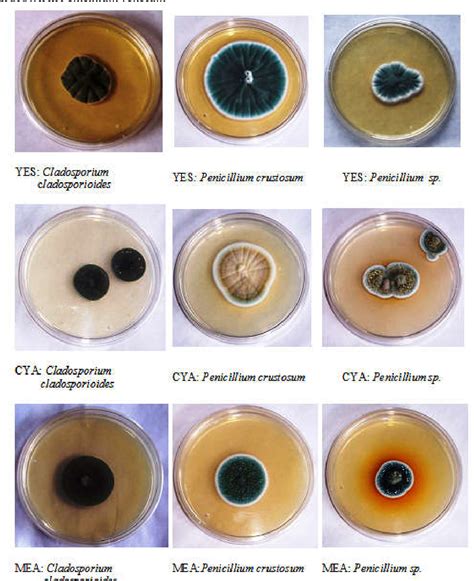 Colonial and Morphological Characteristics of various fungi Species Isolated from soil in ...