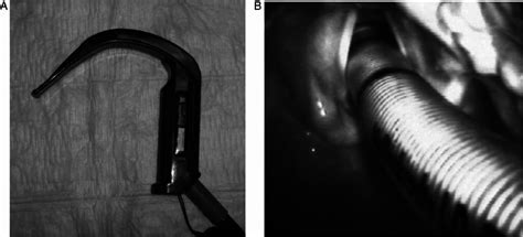 Lateral profile of the Glidescope w blade ( A ) and view of the ...