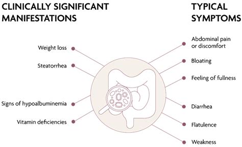 Small Intestinal Bacterial Overgrowth (SIBO) Why Many, 52% OFF