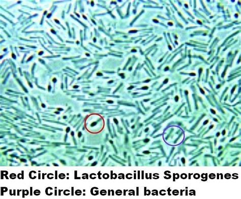 Bacillus coagulans - Alchetron, The Free Social Encyclopedia