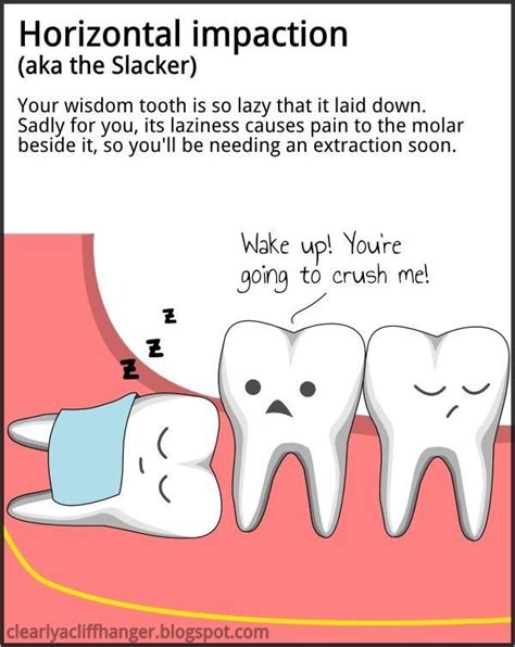 Wisdom Teeth Pain Funny Quotes - ShortQuotes.cc