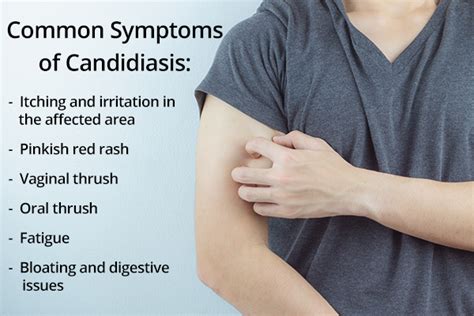 Candidiasis: Causes, Symptoms, Diagnosis, & Treatment