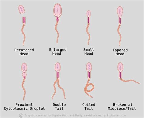 Sperm Morphology Testing | The Reproduction Company Pty Ltd