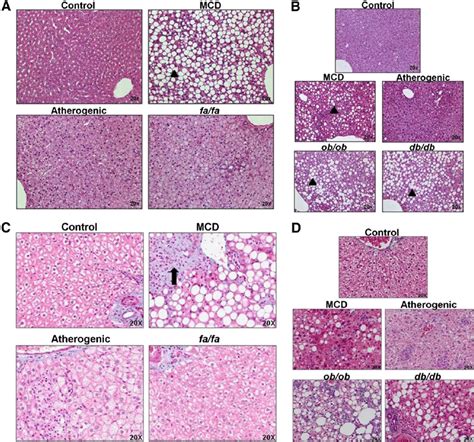 Liver Histology Model