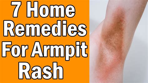 7 Home Remedies For Armpit Rash - YouTube