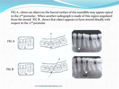 PROJECTION GEOMETRY/ dental implant courses