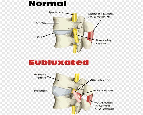 Chiropractic treatment techniques Spinal adjustment Alternative Health Services Health Care ...