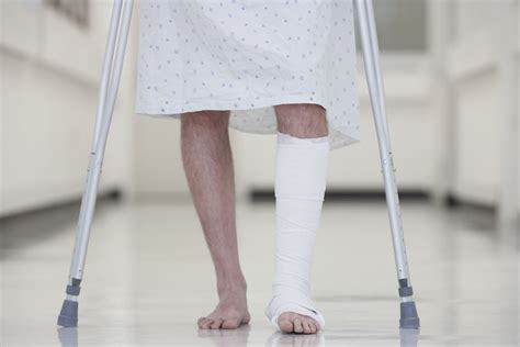 What You Should Know About Ankle Fusion Surgery