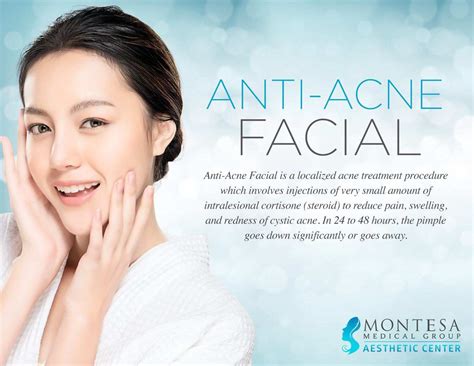 Anti Acne Facial | Montesa Medical Group