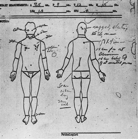 Inside The Autopsy Room: The Details Doctors Gathered About, 49% OFF