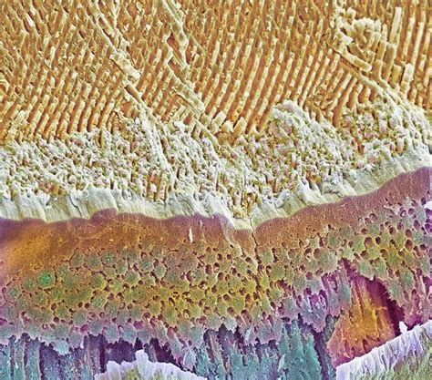 Tooth enamel formation, SEM - Stock Image - P486/0081 - Science Photo Library