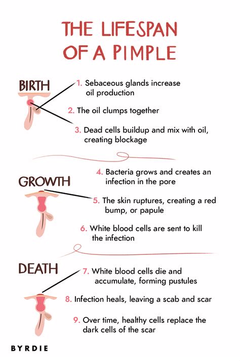 Pimples: How Do They Form and How Long Do They Last?