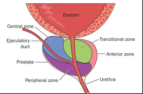 Prostate Zones And Prostate Cancer | Prostate Laser Center