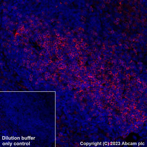 Recombinant Alexa Fluor® 647 Anti-CD5 antibody [EPR26533-75] (ab314468) | Abcam