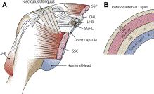 The Rotator Interval: Pathology and Management - Arthroscopy