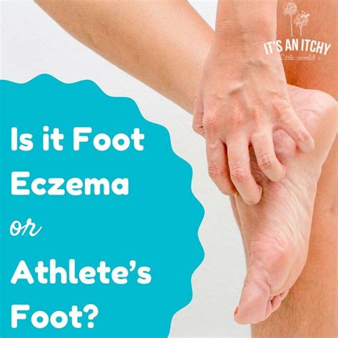 foot eczema - main | Natural cough remedies, Athletes foot remedies ...