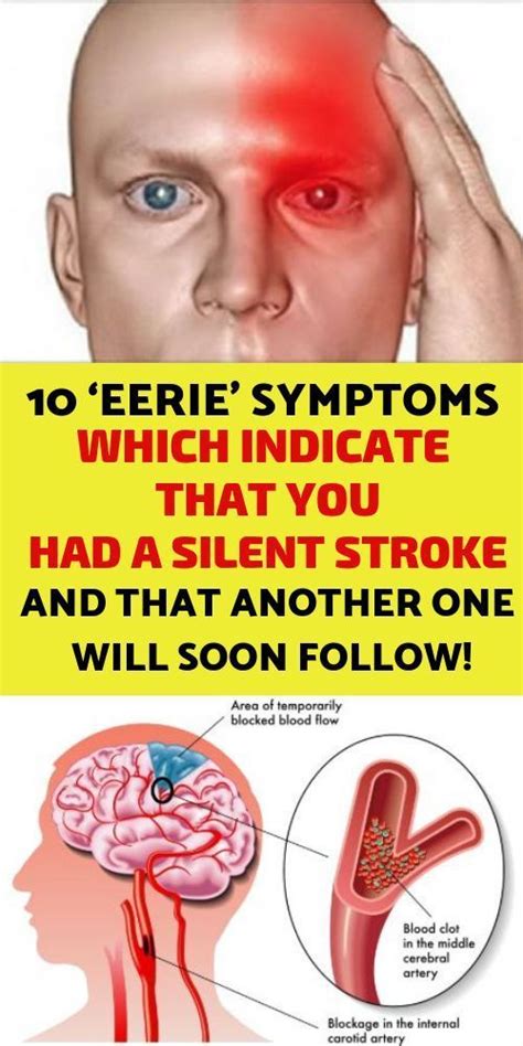 10 ‘Eerie’ Symptoms Which Indicate That You Had A Silent Stroke And ...