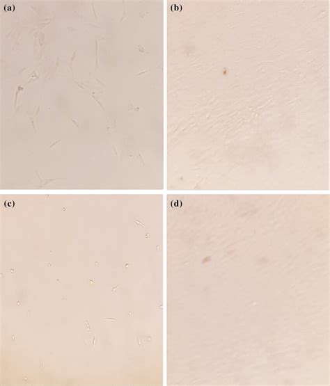 Images of Wharton’s jelly- and cord blood-derived MSCs for adherent ...