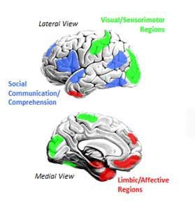 Brain Imaging Shows That Social Brain Circuits Are Disrupted In Autism - BMED Report