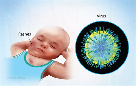 Health Condition : Symptoms, Causes, Treatment and More