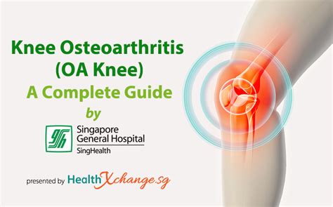 Osteoarthritis Knee Swelling