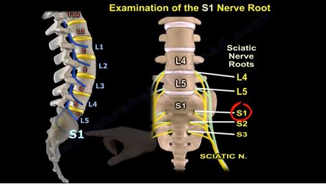 Examination Of S1 Nerve Root — OrthopaedicPrinciples.com